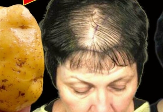 Hair Grows Like Crazy and Doesn’t Fall Out! Discover the Powerful Potato Recipe